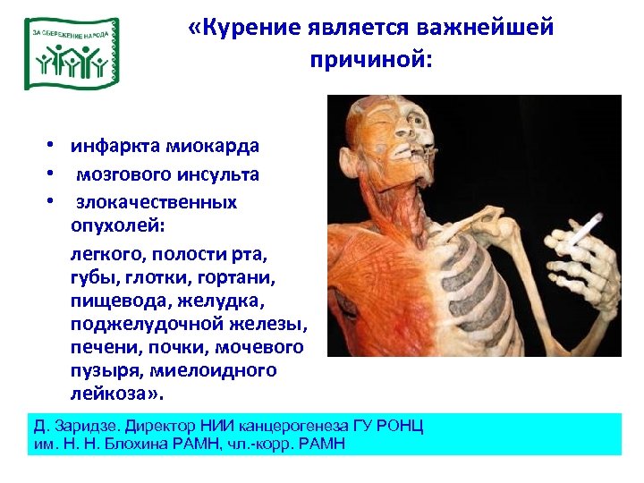  «Курение является важнейшей причиной: • инфаркта миокарда • мозгового инсульта • злокачественных опухолей: