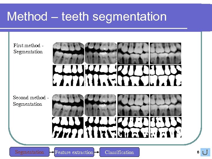 Method – teeth segmentation First method Segmentation Second method Segmentation Feature extraction Classification 6
