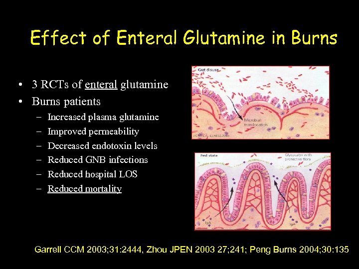 Effect of Enteral Glutamine in Burns • 3 RCTs of enteral glutamine • Burns