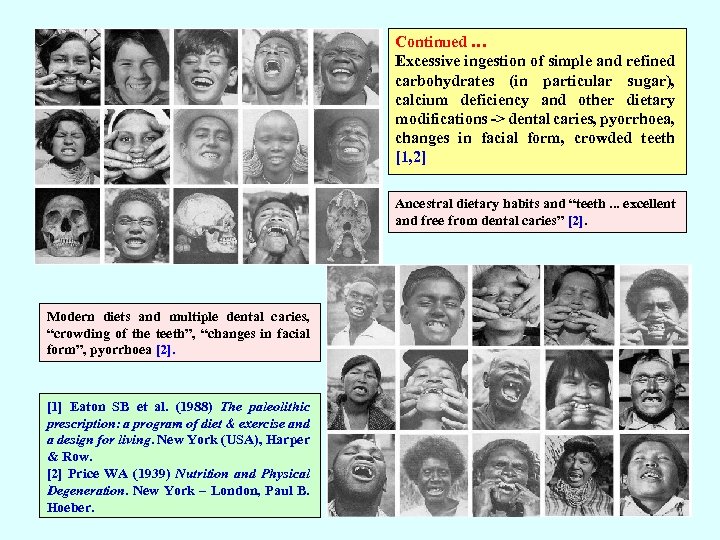 Continued … Excessive ingestion of simple and refined carbohydrates (in particular sugar), calcium deficiency