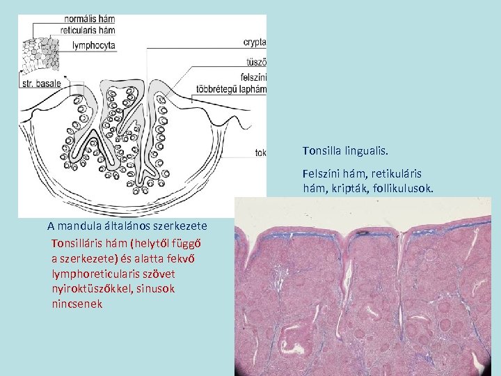 Tonsilla lingualis. Felszíni hám, retikuláris hám, kripták, follikulusok. A mandula általános szerkezete Tonsilláris hám