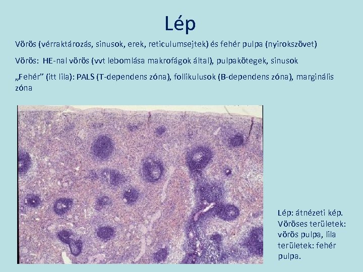 Lép Vörös (vérraktározás, sinusok, erek, reticulumsejtek) és fehér pulpa (nyirokszövet) Vörös: HE-nal vörös (vvt