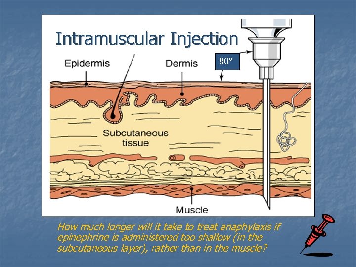 Intramuscular Injection 90º How much longer will it take to treat anaphylaxis if epinephrine