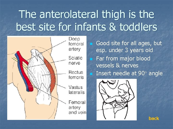 The anterolateral thigh is the best site for infants & toddlers n n n