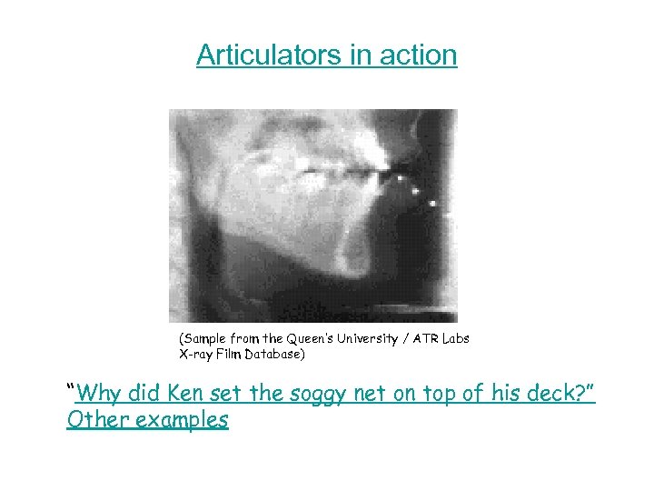 Articulators in action (Sample from the Queen’s University / ATR Labs X-ray Film Database)