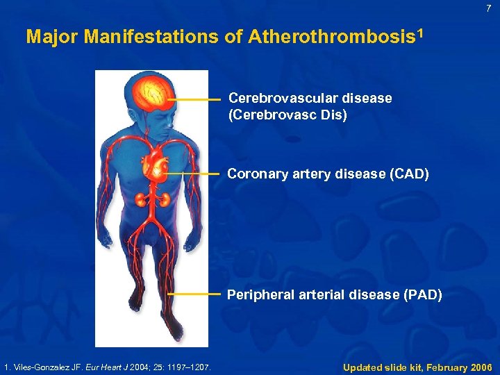 7 Major Manifestations of Atherothrombosis 1 Cerebrovascular disease (Cerebrovasc Dis) Coronary artery disease (CAD)