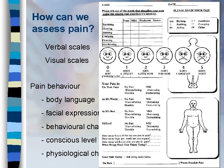 How can we assess pain? Verbal scales Visual scales Pain behaviour - body language