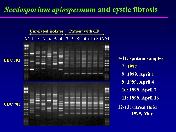 Scedosporium apiospermum and cystic fibrosis Unrelated isolates Patient with CF M 1 2 3