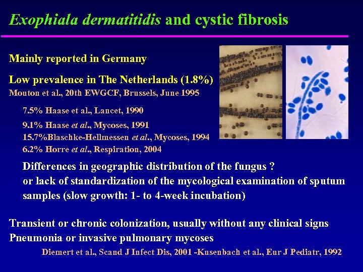 Exophiala dermatitidis and cystic fibrosis Mainly reported in Germany Low prevalence in The Netherlands