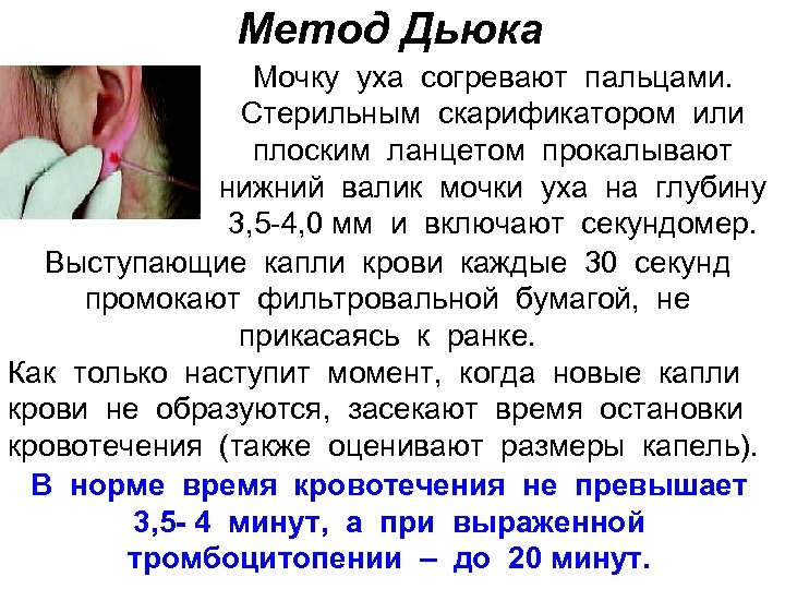 Метод Дьюка Мочку уха согревают пальцами. Стерильным скарификатором или плоским ланцетом прокалывают нижний валик