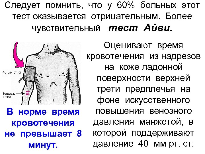 Следует помнить, что у 60% больных этот тест оказывается отрицательным. Более чувствительный тест Айви.