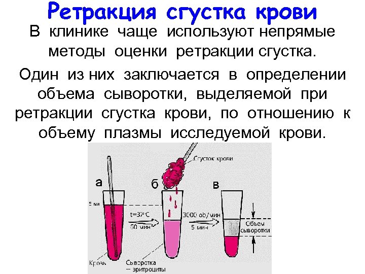 Ретракция сгустка крови В клинике чаще используют непрямые методы оценки ретракции сгустка. Один из