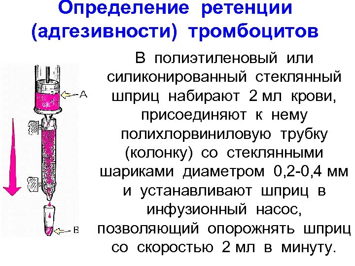 Определение ретенции (адгезивности) тромбоцитов В полиэтиленовый или силиконированный стеклянный шприц набирают 2 мл крови,