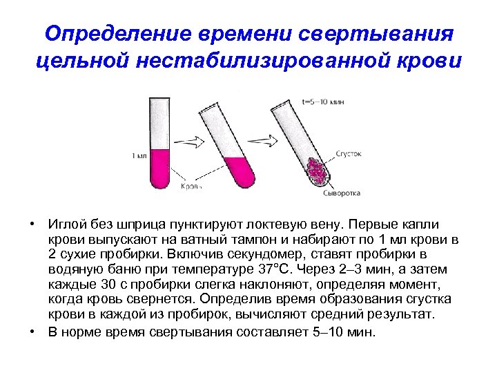 Определение времени свертывания цельной нестабилизированной крови • Иглой без шприца пунктируют локтевую вену. Первые