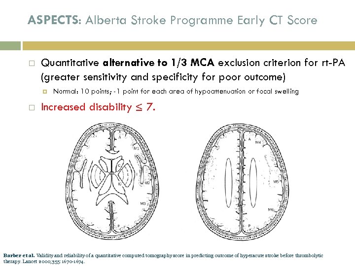 ASPECTS: Alberta Stroke Programme Early CT Score Quantitative alternative to 1/3 MCA exclusion criterion