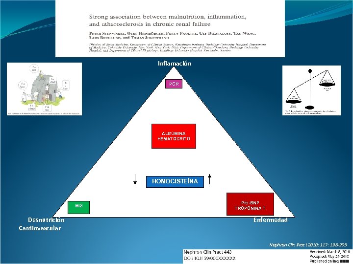 Inflamación PCR ALBÚMINA HEMATOCRITO HOMOCISTEÍNA MIS Desnutrición Cardiovascular Pro-BNP TROPONINA T Enfermedad Nephron Clin