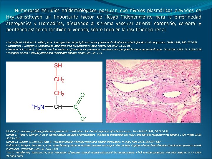 Numerosos estudios epidemiológicos postulan que niveles plasmáticos elevados de Hcy constituyen un importante factor