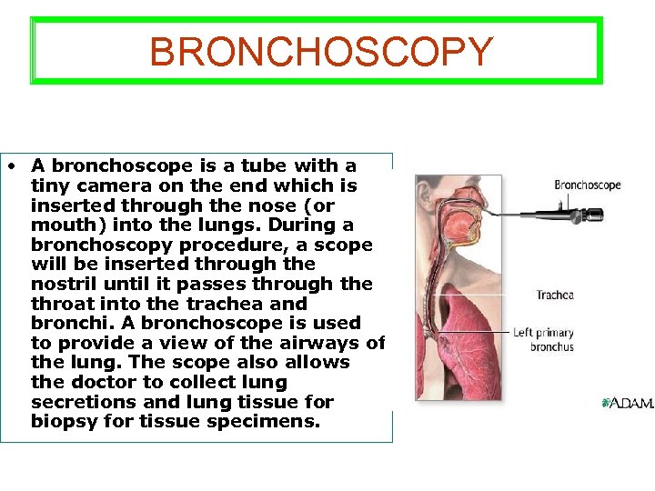 BRONCHOSCOPY • A bronchoscope is a tube with a tiny camera on the end