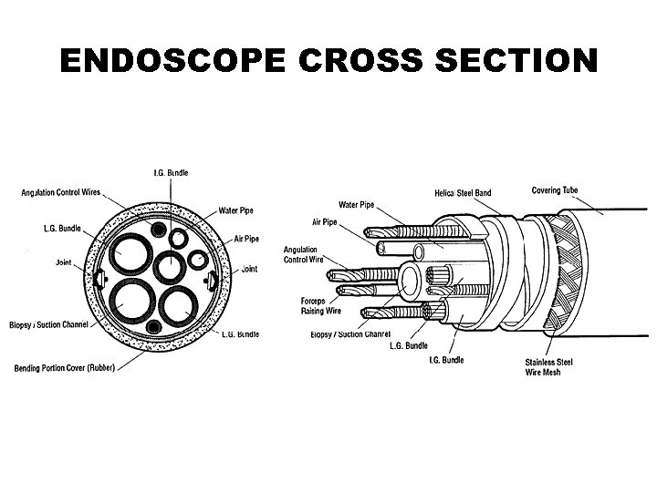 ENDOSCOPE CROSS SECTION 