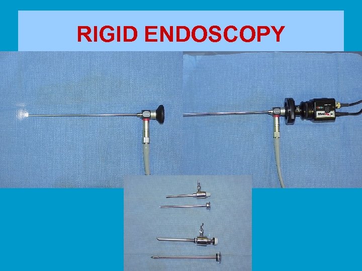 RIGID ENDOSCOPY 