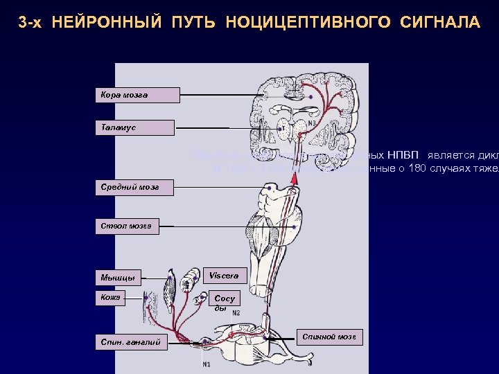 Ноцицептивная боль схема