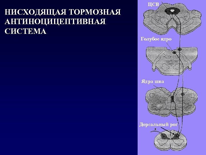 ЦСВ НИСХОДЯЩАЯ ТОРМОЗНАЯ АНТИНОЦИЦЕПТИВНАЯ СИСТЕМА Голубое ядро Ядра шва Дорсальный рог 