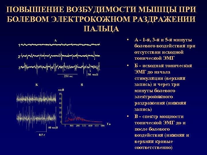 ПОВЫШЕНИЕ ВОЗБУДИМОСТИ МЫШЦЫ ПРИ БОЛЕВОМ ЭЛЕКТРОКОЖНОМ РАЗДРАЖЕНИИ ПАЛЬЦА • • • А - 1