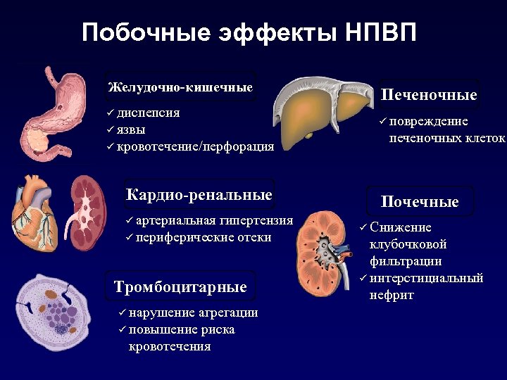 Побочные эффекты НПВП Желудочно-кишечные ü диспепсия ü язвы ü кровотечение/перфорация Кардио-ренальные ü артериальная гипертензия