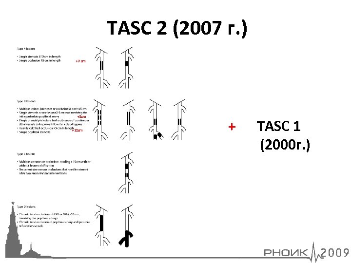 TASC 2 (2007 г. ) +7 cm +2 cm +12 cm + TASC 1