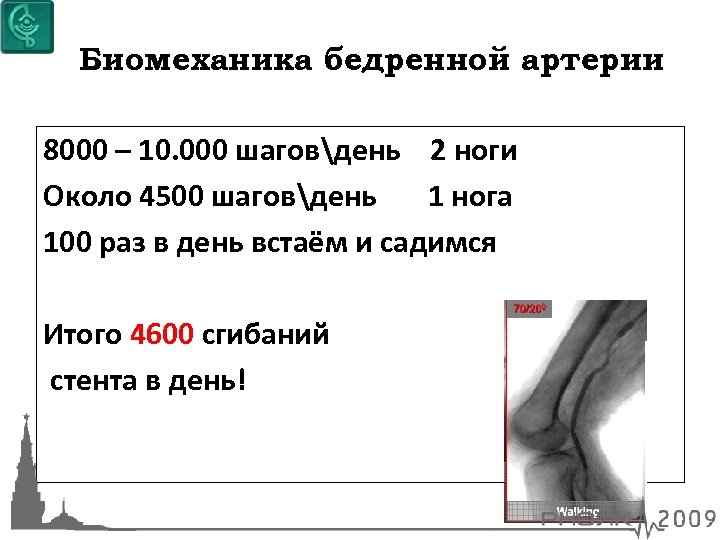 Биомеханика бедренной артерии 8000 – 10. 000 шаговдень 2 ноги Около 4500 шаговдень 1