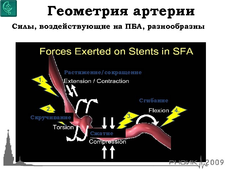 Геометрия артерии Силы, воздействующие на ПБА, разнообразны Растяжение/сокращение Сгибание Скручивание Сжатие 