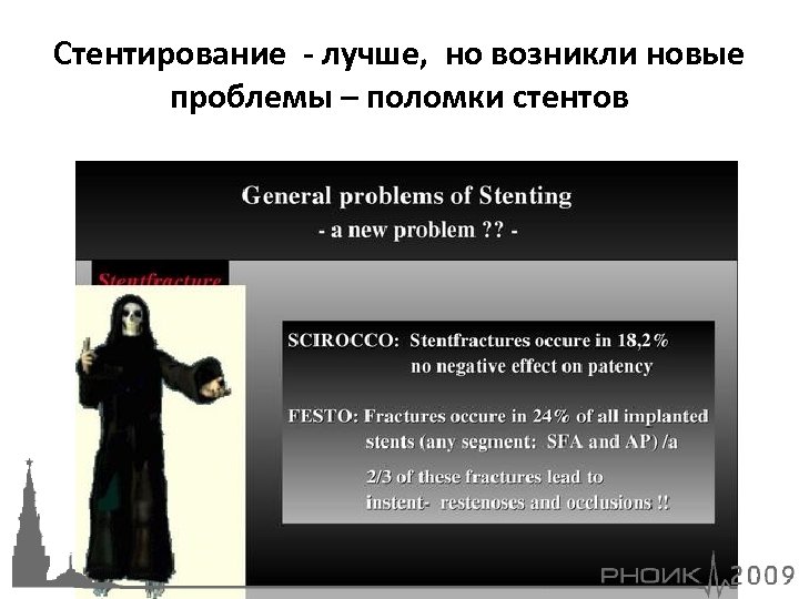 Стентирование - лучше, но возникли новые проблемы – поломки стентов 