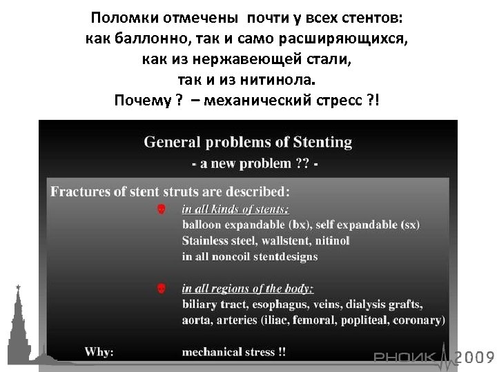 Поломки отмечены почти у всех стентов: как баллонно, так и само расширяющихся, как из