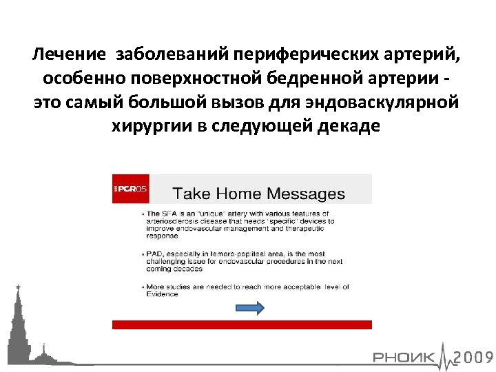 Лечение заболеваний периферических артерий, особенно поверхностной бедренной артерии это самый большой вызов для эндоваскулярной