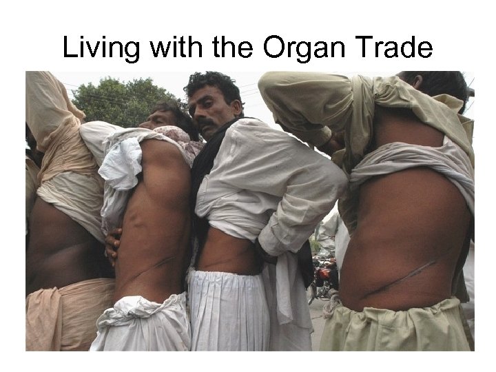 Living with the Organ Trade 