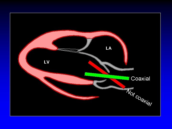 LA LV Coaxial No tc oa xia l 