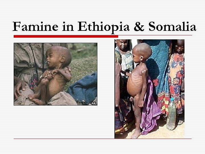 Famine in Ethiopia & Somalia 