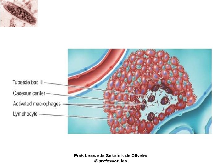 Prof. Leonardo Sokolnik de Oliveira @professor_leo 