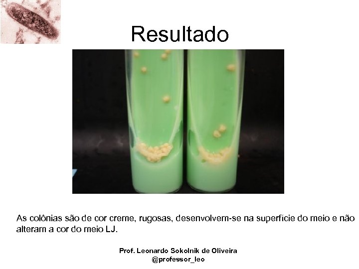 Resultado As colônias são de cor creme, rugosas, desenvolvem-se na superfície do meio e