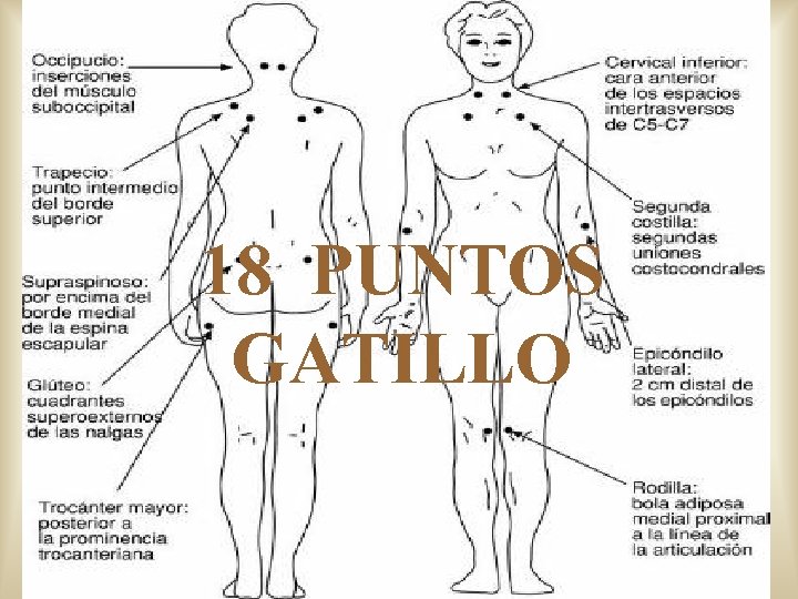 18 PUNTOS GATILLO 