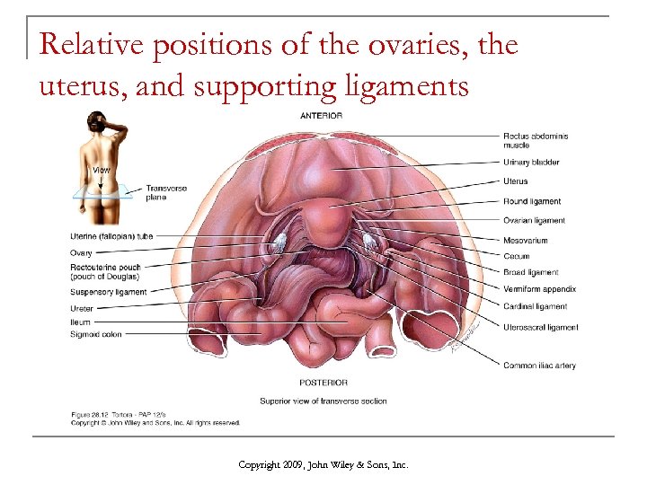 Relative positions of the ovaries, the uterus, and supporting ligaments Copyright 2009, John Wiley