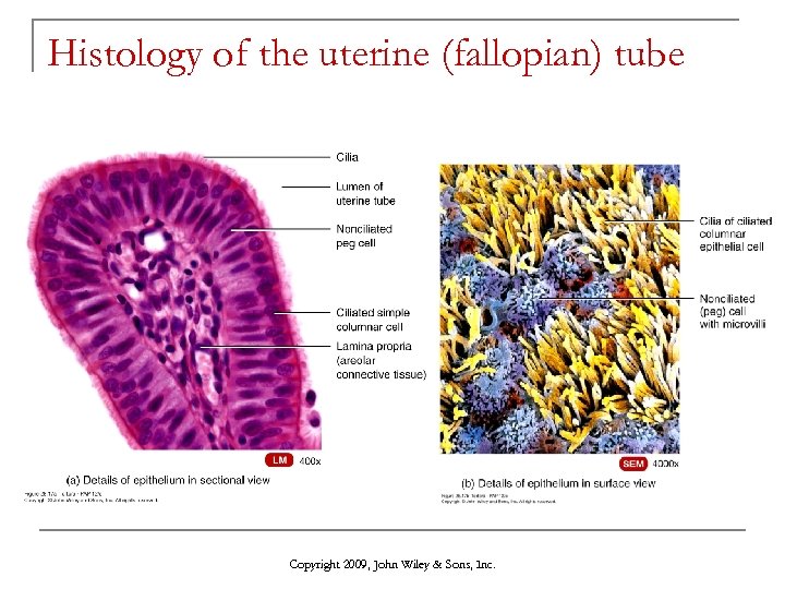 Histology of the uterine (fallopian) tube Copyright 2009, John Wiley & Sons, Inc. 