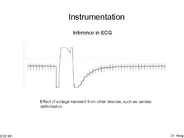 Instrumentation Inference in ECG Effect of voltage transient from other devices, such as cardiac