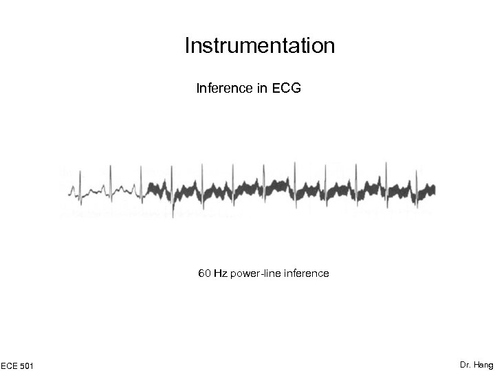 Instrumentation Inference in ECG 60 Hz power-line inference ECE 501 Dr. Hang 