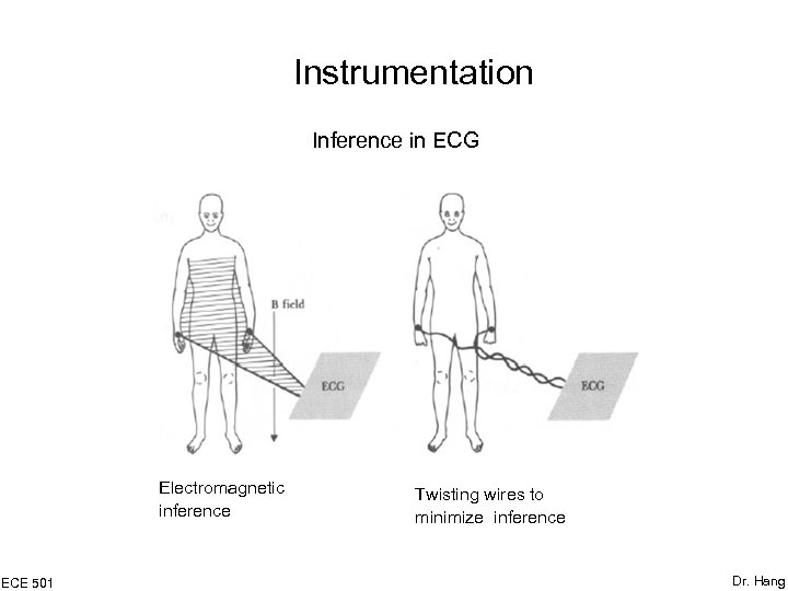 Instrumentation Inference in ECG Electromagnetic inference ECE 501 Twisting wires to minimize inference Dr.
