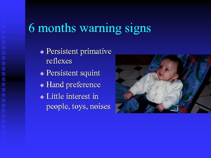 6 months warning signs Persistent primative reflexes u Persistent squint u Hand preference u