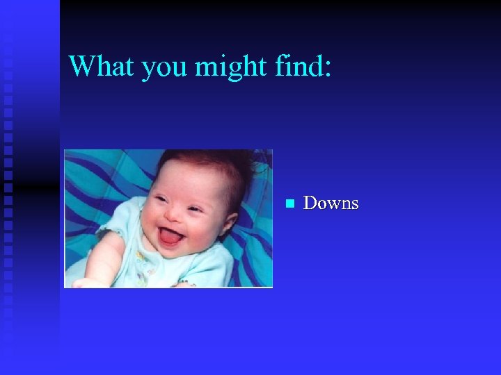 What you might find: n Downs 
