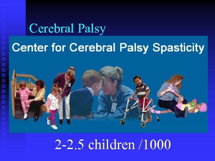 Cerebral Palsy 2 -2. 5 children /1000 