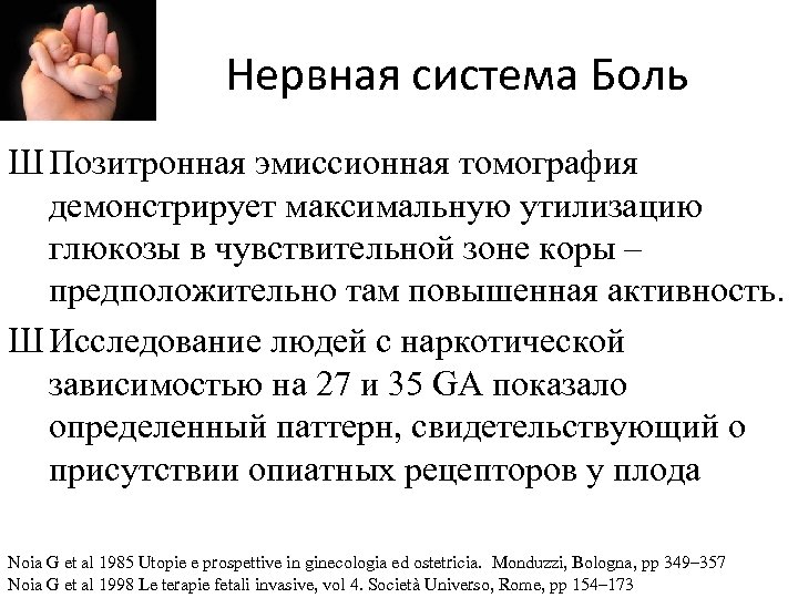 Нервная система Боль Ш Позитронная эмиссионная томография демонстрирует максимальную утилизацию глюкозы в чувствительной зоне