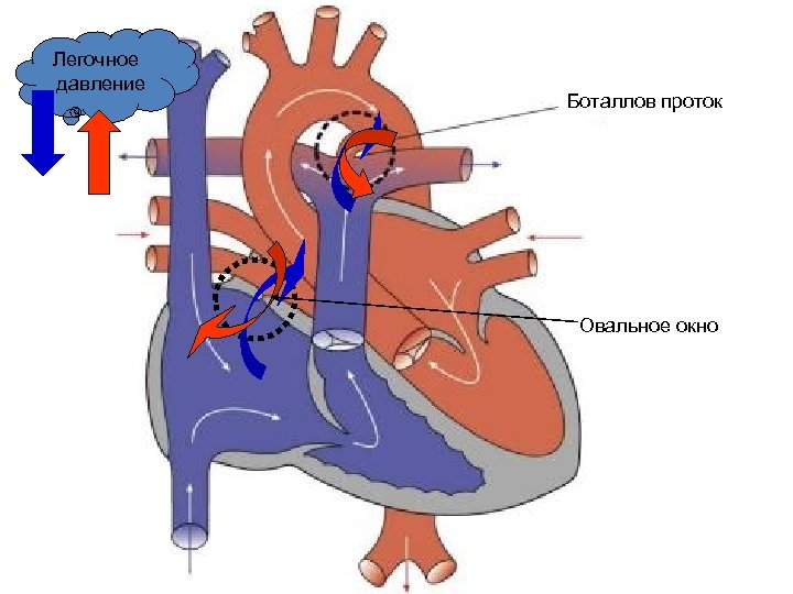 Легочное давление Боталлов проток Овальное окно 